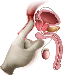 Prostat illustration